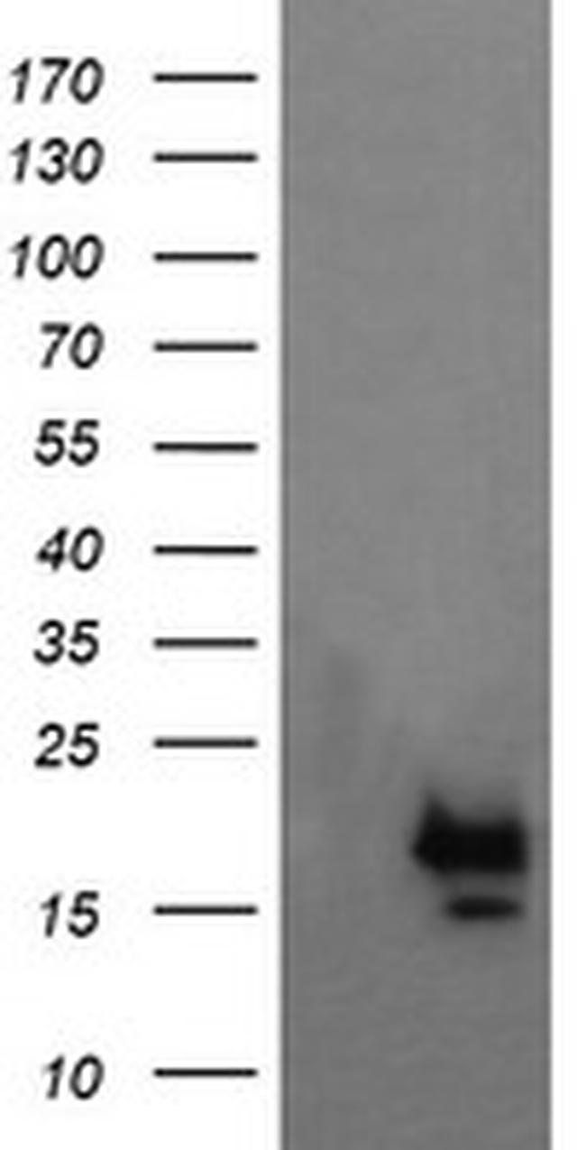 NKIRAS1 Antibody in Western Blot (WB)