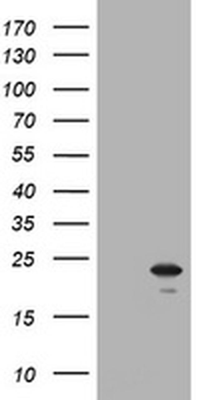 NKIRAS1 Antibody in Western Blot (WB)