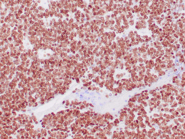 NKX2.2 Antibody in Immunohistochemistry (Paraffin) (IHC (P))