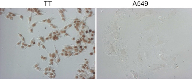 NKX2 Antibody in Immunocytochemistry (ICC/IF)