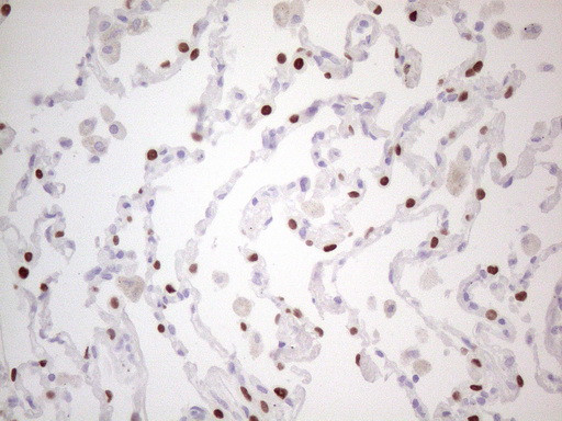 NKX2 Antibody in Immunohistochemistry (Paraffin) (IHC (P))