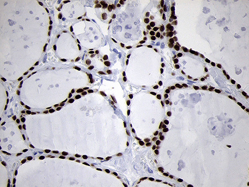 NKX2 Antibody in Immunohistochemistry (Paraffin) (IHC (P))