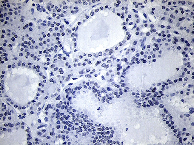 NKX2 Antibody in Immunohistochemistry (Paraffin) (IHC (P))