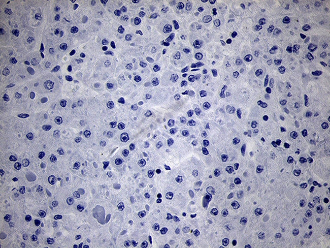 NKX2 Antibody in Immunohistochemistry (Paraffin) (IHC (P))