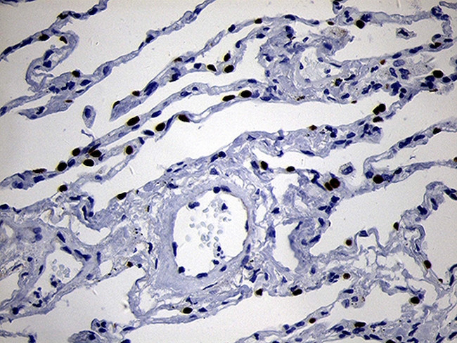 NKX2 Antibody in Immunohistochemistry (Paraffin) (IHC (P))