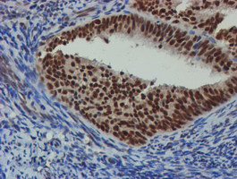 NLN Antibody in Immunohistochemistry (Paraffin) (IHC (P))