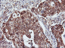 NLN Antibody in Immunohistochemistry (Paraffin) (IHC (P))