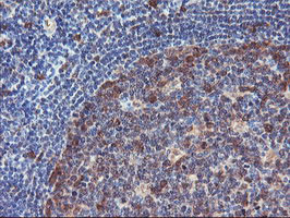 NLN Antibody in Immunohistochemistry (Paraffin) (IHC (P))