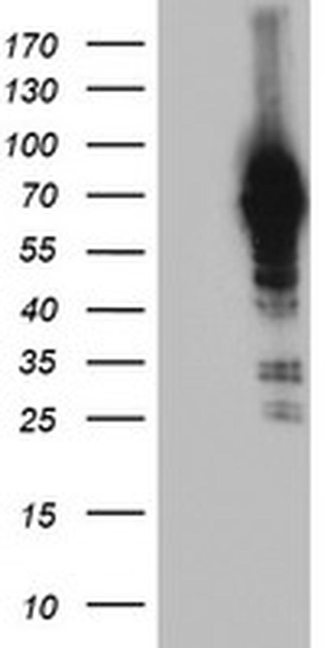 NLN Antibody in Western Blot (WB)