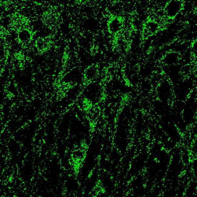 NMDAR1 Antibody in Immunohistochemistry (IHC)