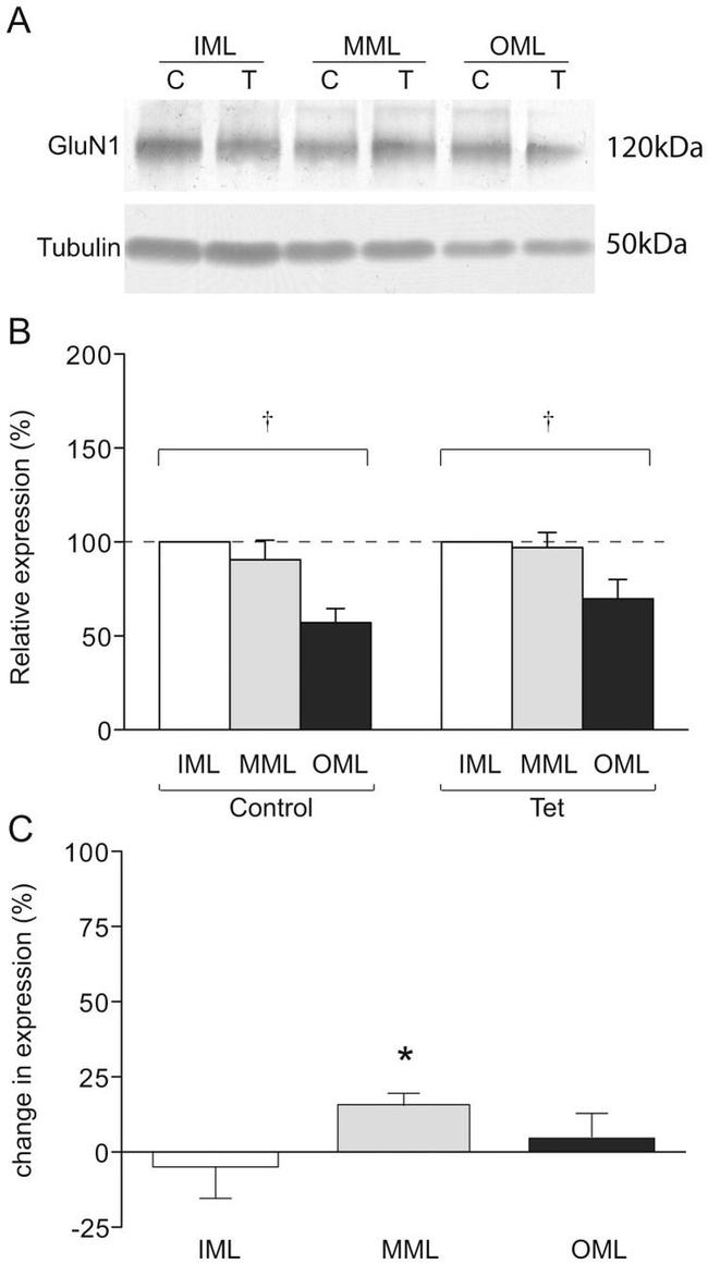 NMDAR1 Antibody in Western Blot (WB)