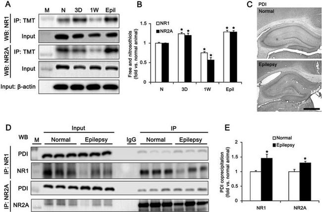 NMDAR2A Antibody in Western Blot, Immunoprecipitation (WB, IP)