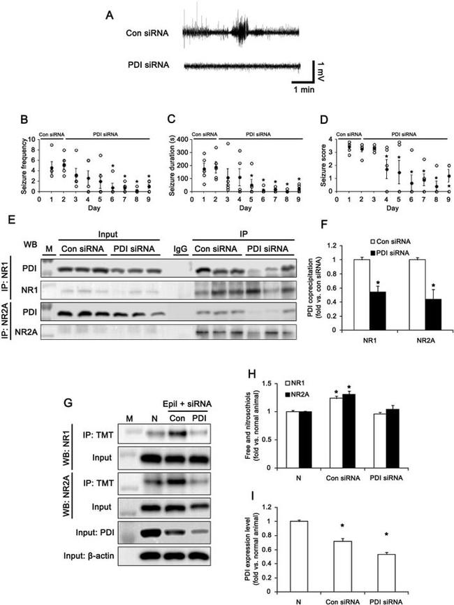 NMDAR2A Antibody in Western Blot, Immunoprecipitation (WB, IP)