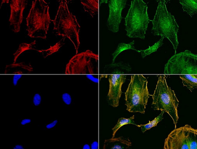 NME1 Antibody in Immunocytochemistry (ICC/IF)