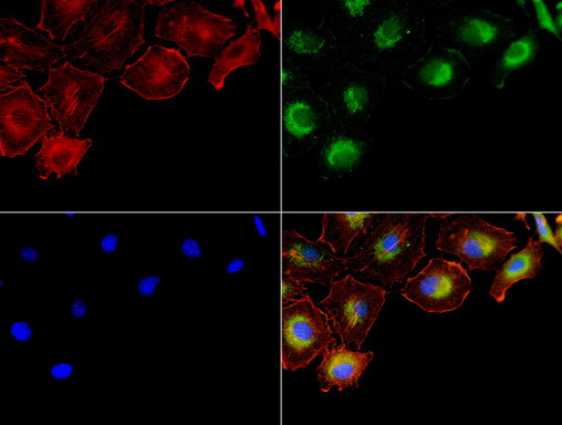 NME1 Antibody in Immunocytochemistry (ICC/IF)