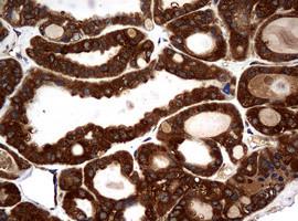 NME1 Antibody in Immunohistochemistry (Paraffin) (IHC (P))