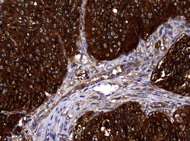 NME1 Antibody in Immunohistochemistry (Paraffin) (IHC (P))