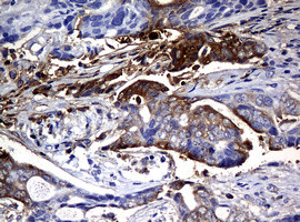 NME1 Antibody in Immunohistochemistry (Paraffin) (IHC (P))