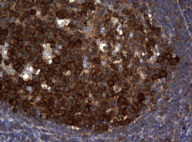 NME1 Antibody in Immunohistochemistry (Paraffin) (IHC (P))