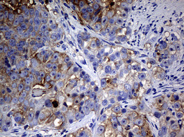 NME1 Antibody in Immunohistochemistry (Paraffin) (IHC (P))