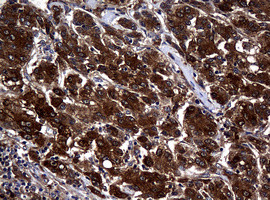 NME1 Antibody in Immunohistochemistry (Paraffin) (IHC (P))