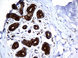 NME1 Antibody in Immunohistochemistry (Paraffin) (IHC (P))