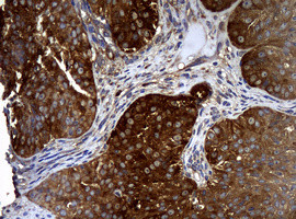 NME1 Antibody in Immunohistochemistry (Paraffin) (IHC (P))