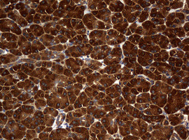 NME1 Antibody in Immunohistochemistry (Paraffin) (IHC (P))