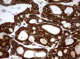 NME1 Antibody in Immunohistochemistry (Paraffin) (IHC (P))