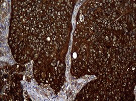 NME1 Antibody in Immunohistochemistry (Paraffin) (IHC (P))