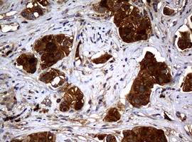 NME1 Antibody in Immunohistochemistry (Paraffin) (IHC (P))