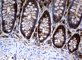 NME1 Antibody in Immunohistochemistry (Paraffin) (IHC (P))