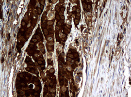 NME1 Antibody in Immunohistochemistry (Paraffin) (IHC (P))