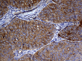 NME1 Antibody in Immunohistochemistry (Paraffin) (IHC (P))