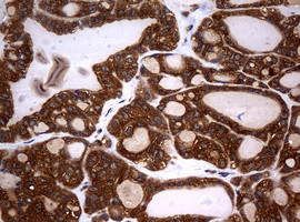 NME1 Antibody in Immunohistochemistry (Paraffin) (IHC (P))