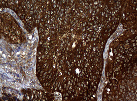 NME1 Antibody in Immunohistochemistry (Paraffin) (IHC (P))