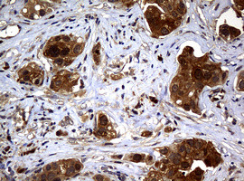 NME1 Antibody in Immunohistochemistry (Paraffin) (IHC (P))