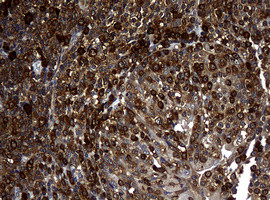 NME1 Antibody in Immunohistochemistry (Paraffin) (IHC (P))