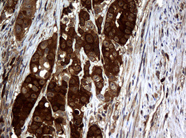 NME1 Antibody in Immunohistochemistry (Paraffin) (IHC (P))