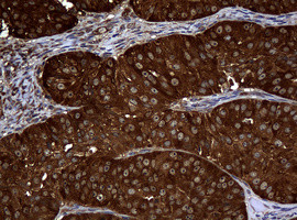 NME1 Antibody in Immunohistochemistry (Paraffin) (IHC (P))