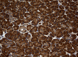 NME1 Antibody in Immunohistochemistry (Paraffin) (IHC (P))