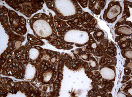 NME1 Antibody in Immunohistochemistry (Paraffin) (IHC (P))