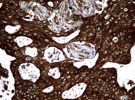 NME1 Antibody in Immunohistochemistry (Paraffin) (IHC (P))