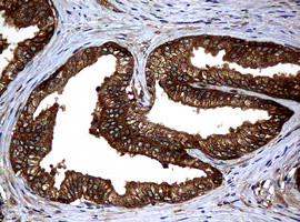 NME1 Antibody in Immunohistochemistry (Paraffin) (IHC (P))