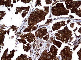 NME1 Antibody in Immunohistochemistry (Paraffin) (IHC (P))