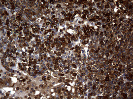 NME1 Antibody in Immunohistochemistry (Paraffin) (IHC (P))