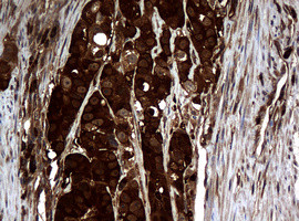 NME1 Antibody in Immunohistochemistry (Paraffin) (IHC (P))