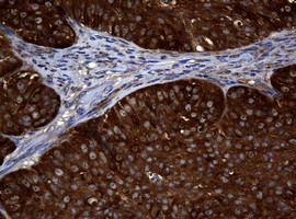 NME1 Antibody in Immunohistochemistry (Paraffin) (IHC (P))