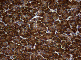 NME1 Antibody in Immunohistochemistry (Paraffin) (IHC (P))