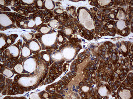 NME1 Antibody in Immunohistochemistry (Paraffin) (IHC (P))